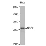 Western blot - NQO2 Antibody from Signalway Antibody (32849) - Antibodies.com