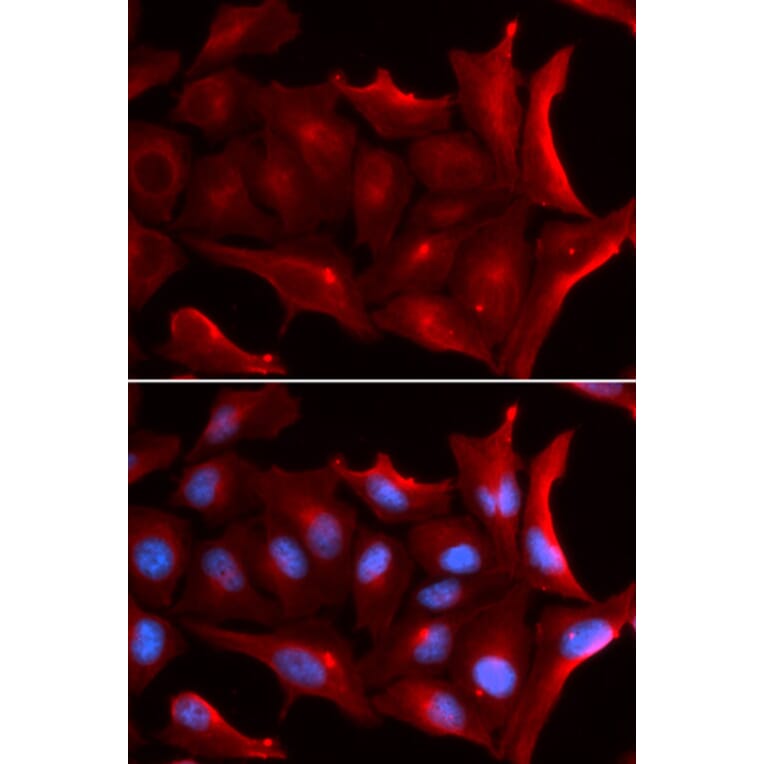 Immunofluorescence - NQO2 Antibody from Signalway Antibody (32849) - Antibodies.com