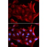 Immunofluorescence - NQO2 Antibody from Signalway Antibody (32849) - Antibodies.com