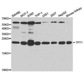 Western blot - TPT1 Antibody from Signalway Antibody (32850) - Antibodies.com