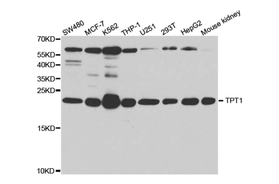 Western blot - TPT1 Antibody from Signalway Antibody (32850) - Antibodies.com