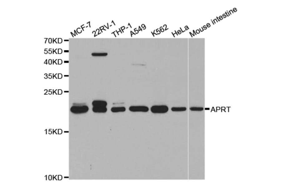 Western blot - APRT Antibody from Signalway Antibody (32859) - Antibodies.com