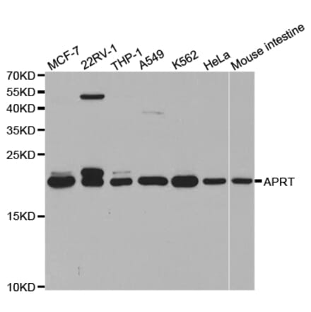 Western blot - APRT Antibody from Signalway Antibody (32859) - Antibodies.com