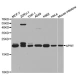 Western blot - APRT Antibody from Signalway Antibody (32859) - Antibodies.com