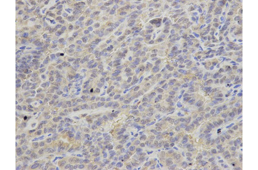 Immunohistochemistry - APRT Antibody from Signalway Antibody (32859) - Antibodies.com