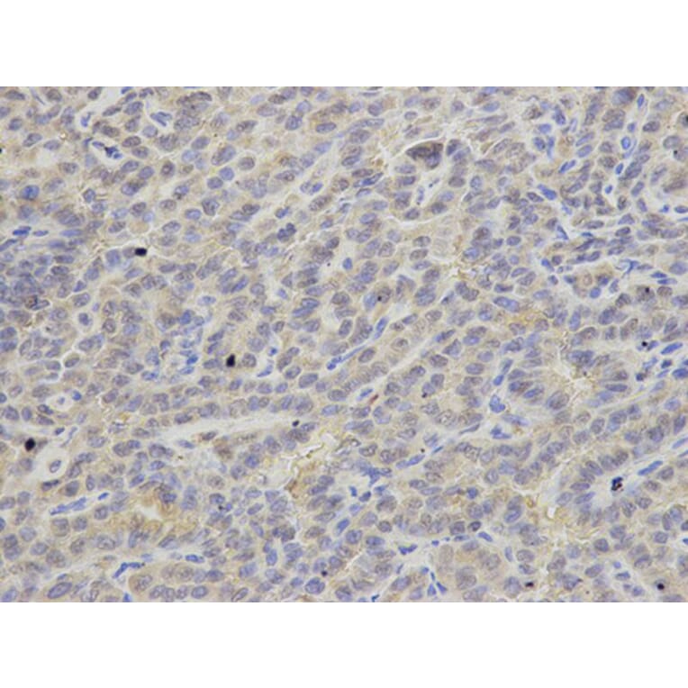 Immunohistochemistry - APRT Antibody from Signalway Antibody (32859) - Antibodies.com