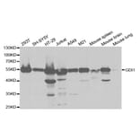 Western blot - GDI1 Antibody from Signalway Antibody (32863) - Antibodies.com