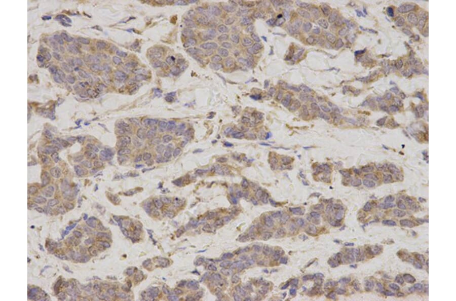 Immunohistochemistry - GDI1 Antibody from Signalway Antibody (32863) - Antibodies.com