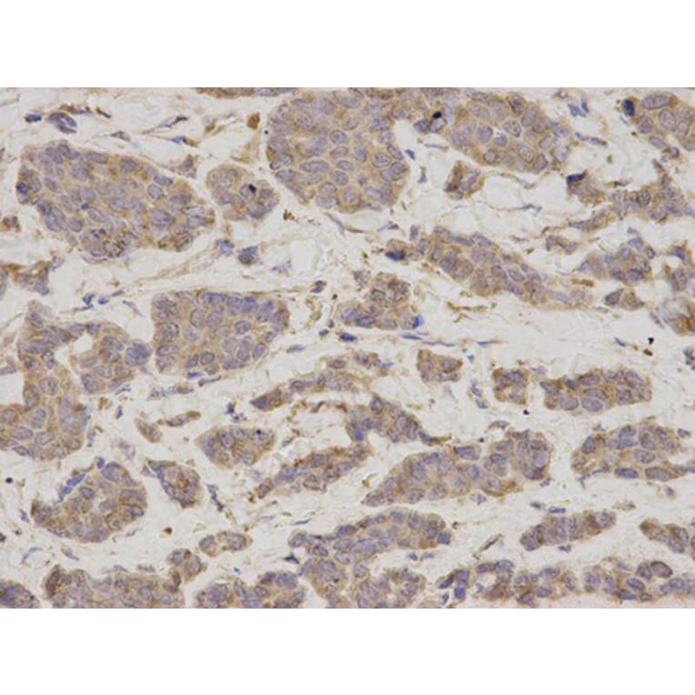 Immunohistochemistry - GDI1 Antibody from Signalway Antibody (32863) - Antibodies.com