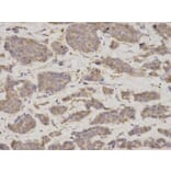 Immunohistochemistry - GDI1 Antibody from Signalway Antibody (32863) - Antibodies.com