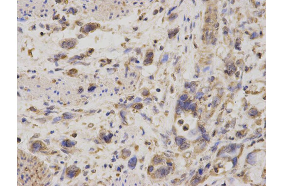 Immunohistochemistry - GDI1 Antibody from Signalway Antibody (32863) - Antibodies.com