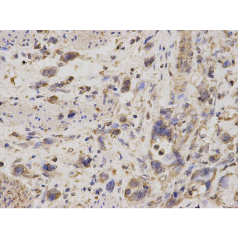 Immunohistochemistry - GDI1 Antibody from Signalway Antibody (32863) - Antibodies.com