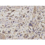 Immunohistochemistry - GDI1 Antibody from Signalway Antibody (32863) - Antibodies.com