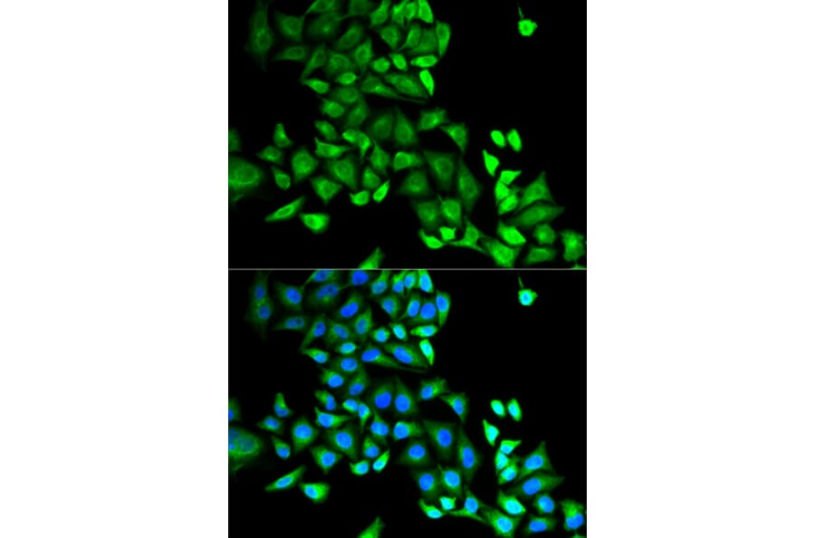 Immunofluorescence - GDI1 Antibody from Signalway Antibody (32863) - Antibodies.com