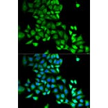 Immunofluorescence - GDI1 Antibody from Signalway Antibody (32863) - Antibodies.com