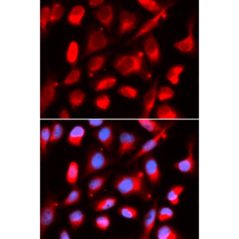 Immunofluorescence - UROD Antibody from Signalway Antibody (32886) - Antibodies.com