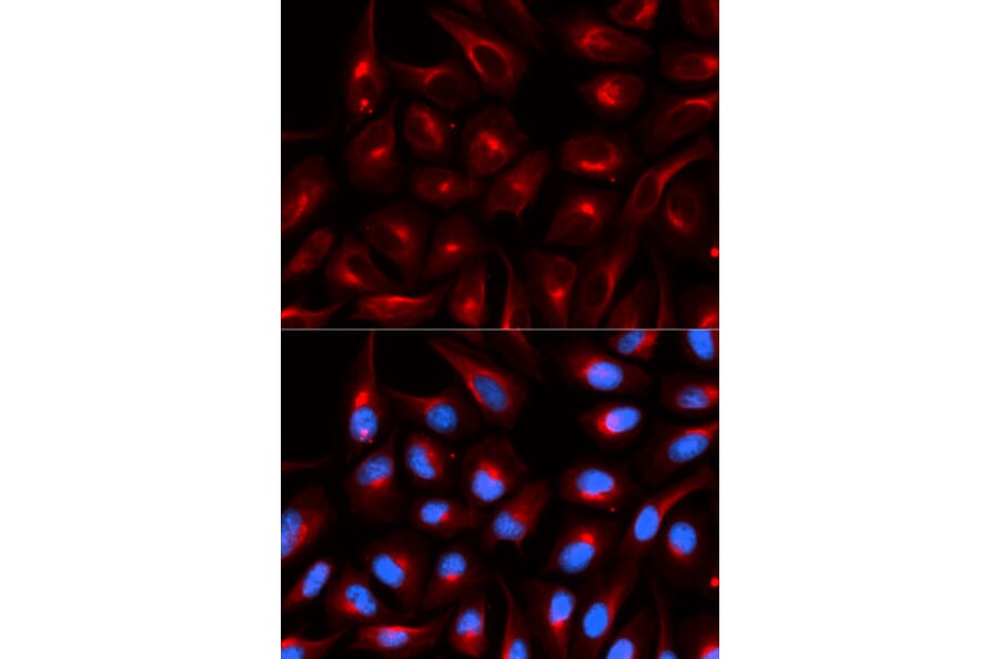 Immunofluorescence - TLE1 Antibody from Signalway Antibody (32891) - Antibodies.com