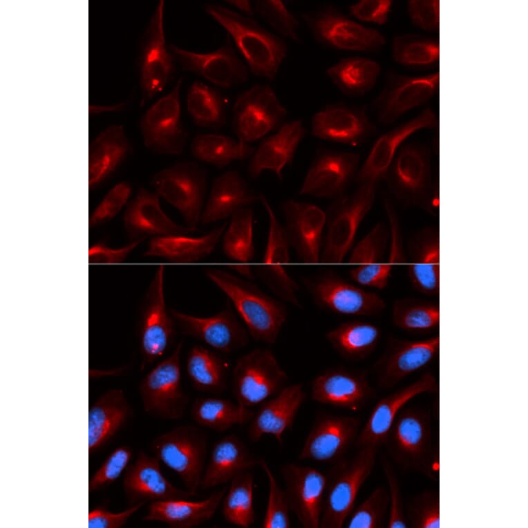 Immunofluorescence - TLE1 Antibody from Signalway Antibody (32891) - Antibodies.com