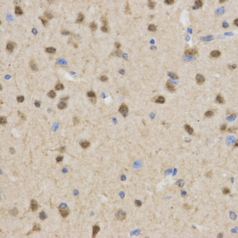 Immunohistochemistry - TLE1 Antibody from Signalway Antibody (32891) - Antibodies.com