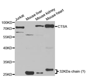 Western blot - CTSA Antibody from Signalway Antibody (32893) - Antibodies.com