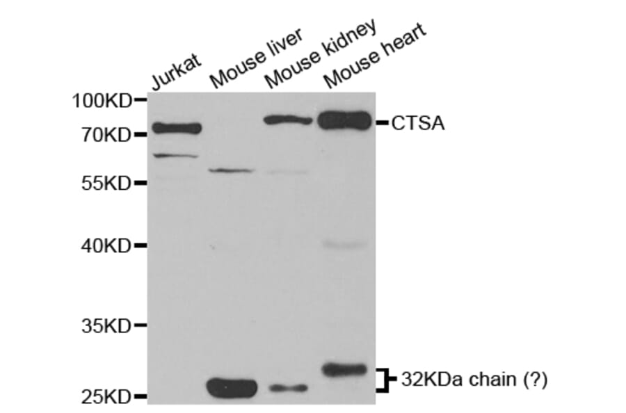 Western blot - CTSA Antibody from Signalway Antibody (32893) - Antibodies.com