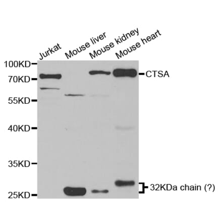 Western blot - CTSA Antibody from Signalway Antibody (32893) - Antibodies.com