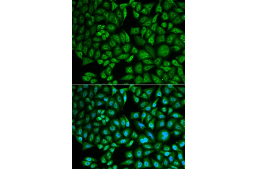 Immunofluorescence - CTSA Antibody from Signalway Antibody (32893) - Antibodies.com