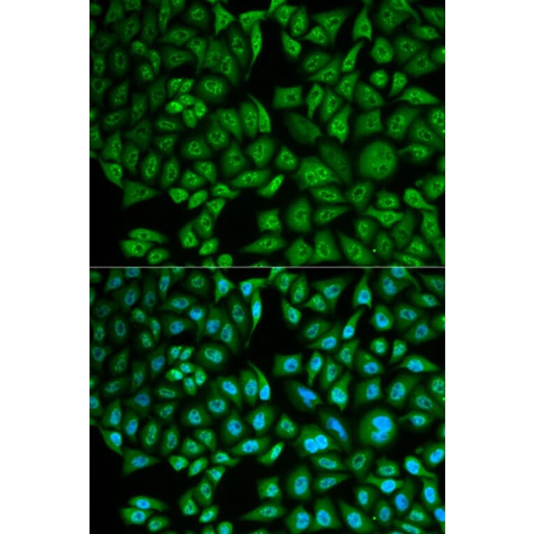 Immunofluorescence - CTSA Antibody from Signalway Antibody (32893) - Antibodies.com