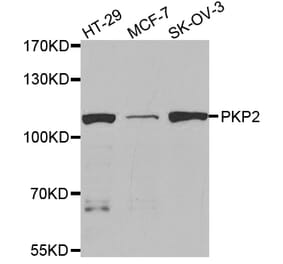 Western blot - PKP2 Antibody from Signalway Antibody (32897) - Antibodies.com