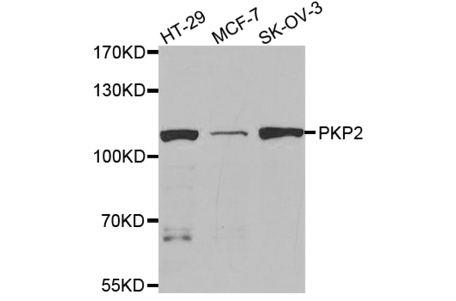 Western blot - PKP2 Antibody from Signalway Antibody (32897) - Antibodies.com