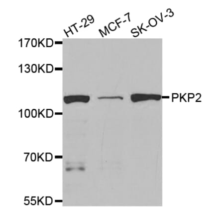 Western blot - PKP2 Antibody from Signalway Antibody (32897) - Antibodies.com