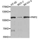 Western blot - PKP2 Antibody from Signalway Antibody (32897) - Antibodies.com