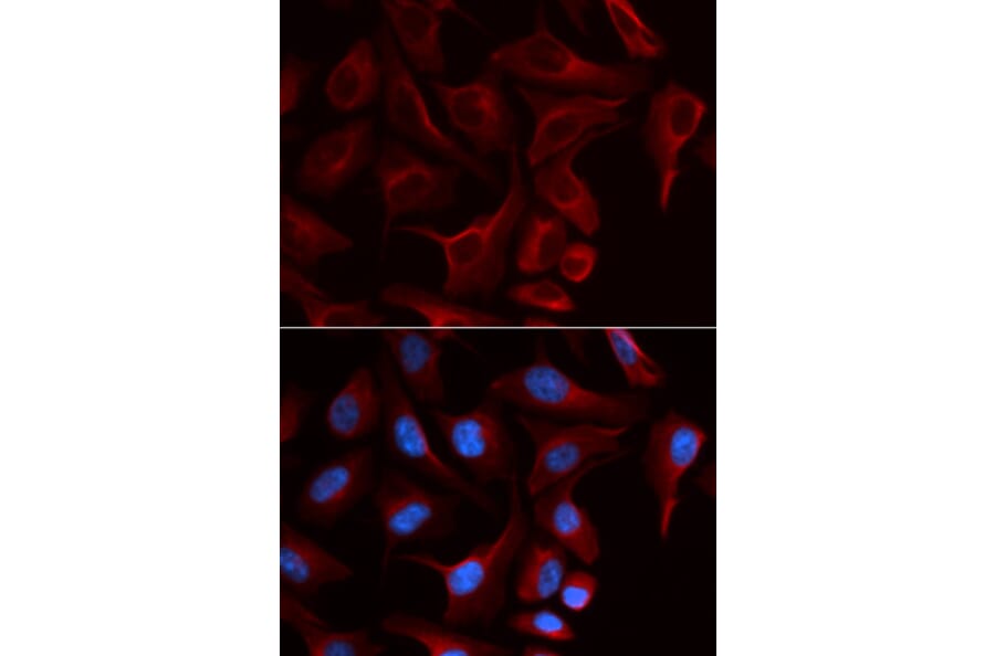 Immunofluorescence - PKP2 Antibody from Signalway Antibody (32897) - Antibodies.com