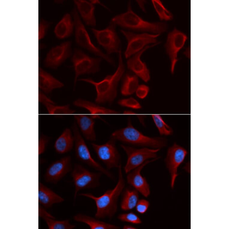 Immunofluorescence - PKP2 Antibody from Signalway Antibody (32897) - Antibodies.com