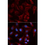 Immunofluorescence - PKP2 Antibody from Signalway Antibody (32897) - Antibodies.com