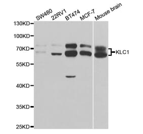 Western blot - KLC1 Antibody from Signalway Antibody (32903) - Antibodies.com