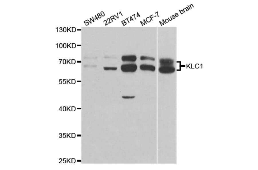 Western blot - KLC1 Antibody from Signalway Antibody (32903) - Antibodies.com