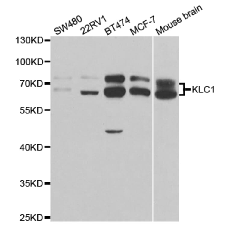 Western blot - KLC1 Antibody from Signalway Antibody (32903) - Antibodies.com