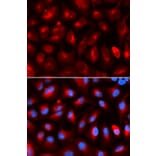 Immunofluorescence - KLC1 Antibody from Signalway Antibody (32903) - Antibodies.com