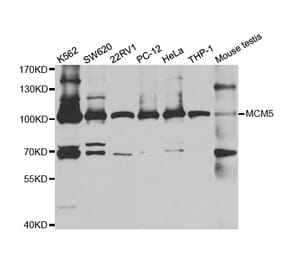 Western blot - MCM5 Antibody from Signalway Antibody (32907) - Antibodies.com
