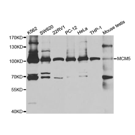 Western blot - MCM5 Antibody from Signalway Antibody (32907) - Antibodies.com