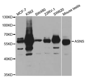 Western blot - ASNS Antibody from Signalway Antibody (32909) - Antibodies.com