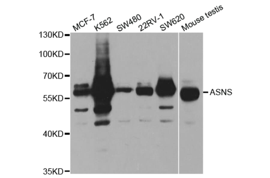 Western blot - ASNS Antibody from Signalway Antibody (32909) - Antibodies.com
