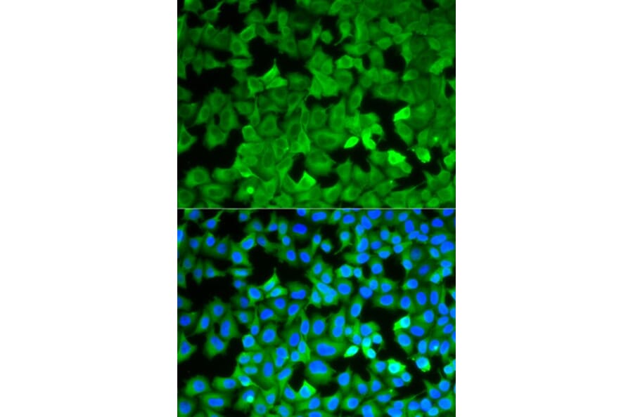 Immunofluorescence - ASNS Antibody from Signalway Antibody (32909) - Antibodies.com