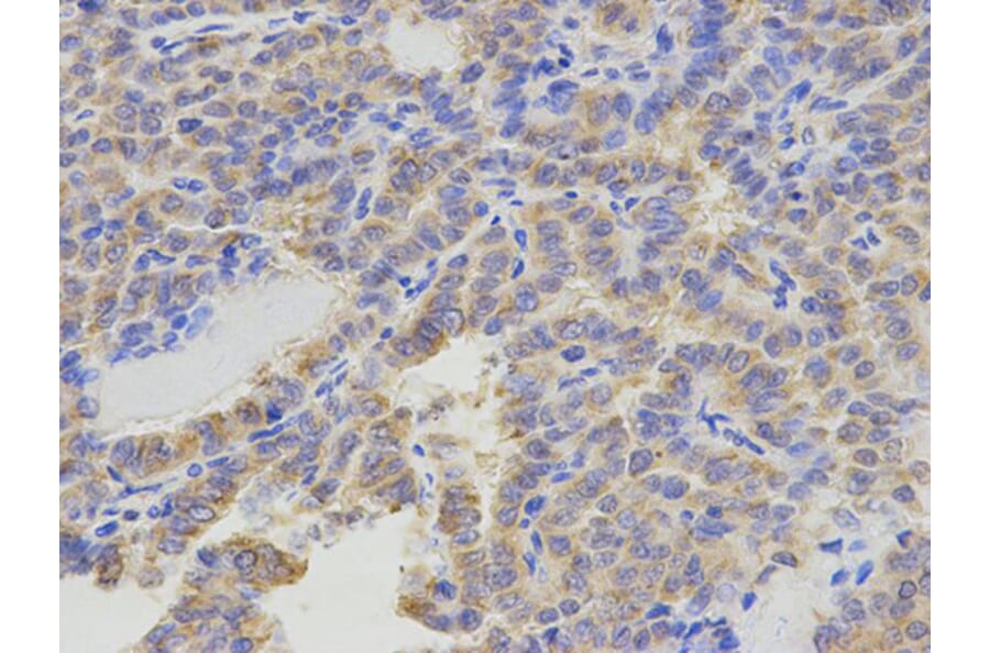 Immunohistochemistry - ATIC Antibody from Signalway Antibody (32910) - Antibodies.com