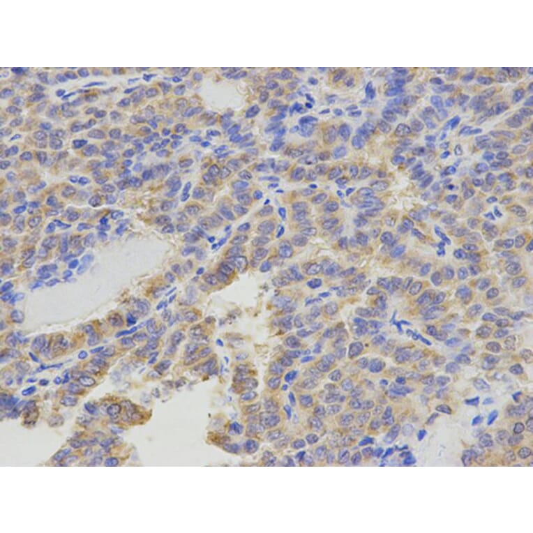 Immunohistochemistry - ATIC Antibody from Signalway Antibody (32910) - Antibodies.com