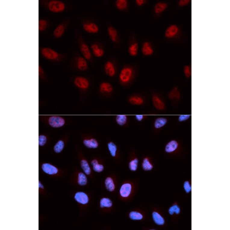 Immunofluorescence - ATIC Antibody from Signalway Antibody (32910) - Antibodies.com