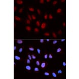 Immunofluorescence - ATIC Antibody from Signalway Antibody (32910) - Antibodies.com