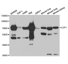 Western blot - LCP1 Antibody from Signalway Antibody (32912) - Antibodies.com