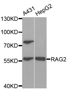 Western blot analysis of extracts of various cell lines, using RAG2 antibody.